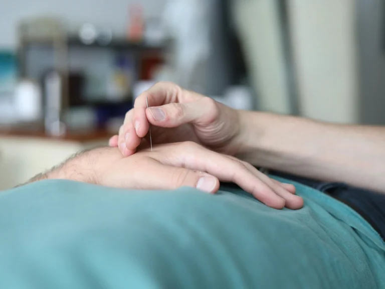 A close-up shot of a practitioner’s hand carefully inserting a thin acupuncture needle into the back of a patient's hand.
